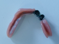 protetika - dental studio Majer